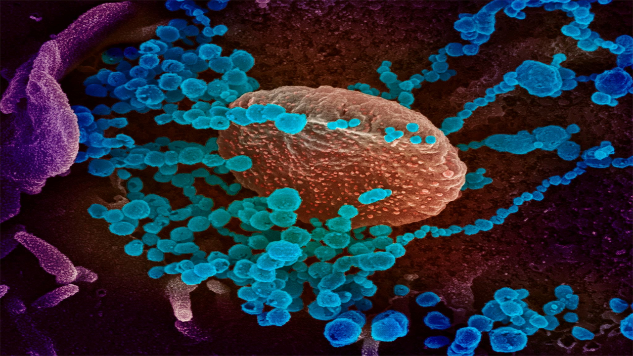 World’s Covid would almost fit on TEASPOON as volume of 53million infections is just 0.2fl oz