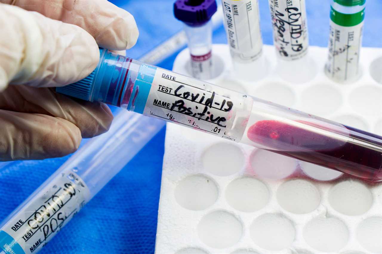 People with blood type A are more likely to catch Covid, study warns