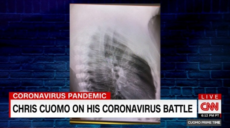 Chris Cuomo gets Covid vaccine at local clinic after Gov bro Andrew ‘ordered officials to give him VIP home testing’