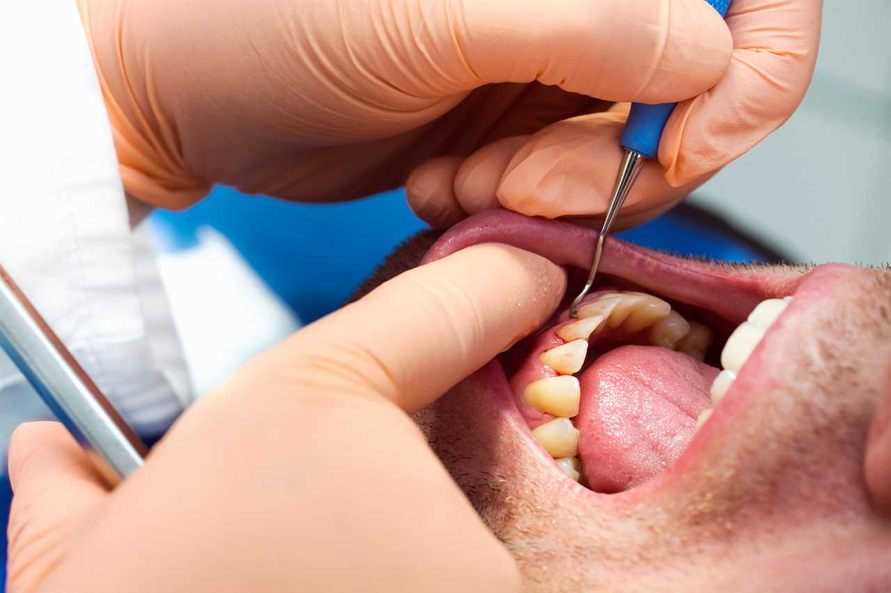 Gum disease ‘increases chance of catching Covid’ – how to tell if you’re at risk?