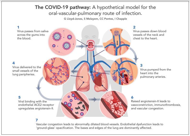 Gum disease ‘increases chance of catching Covid’ – how to tell if you’re at risk?