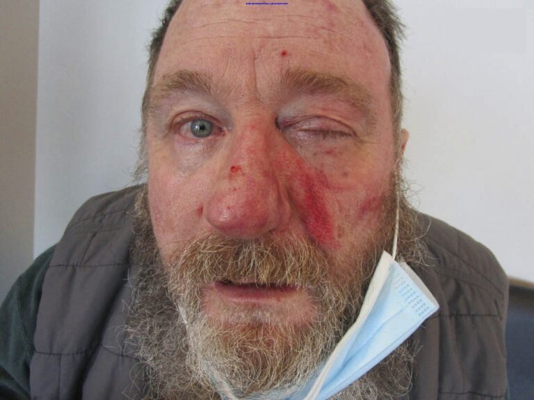 Customer jailed for 10 years for SPITTING in man’s face & saying he infected victim with Covid in store spat over masks