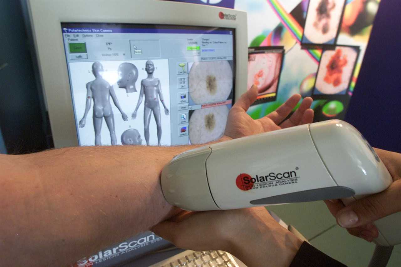 What are skin cancer symptoms and signs and what does the disease look like?