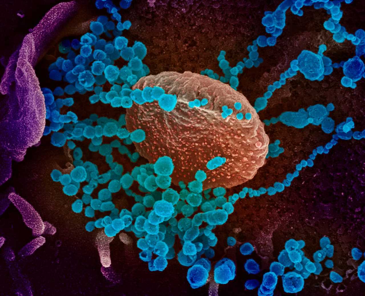 Covid ‘mu’ mutation is in nearly EVERY US state already as WHO warns latest ‘variant of interest’ may evade vaccines