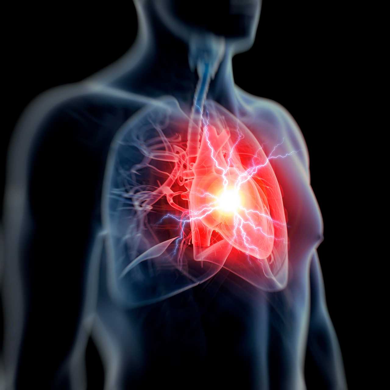 Doctors find drug which boosts chance of recovery from heart attacks