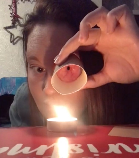 I was diagnosed with rare deadly cancer and had my eye removed – now I can blow out candles through my empty socket