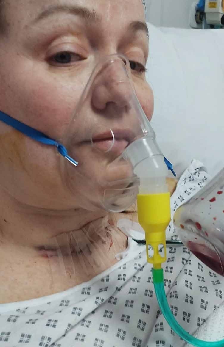 Woman who thought her sore throat was long Covid turned out to have TWO cancers