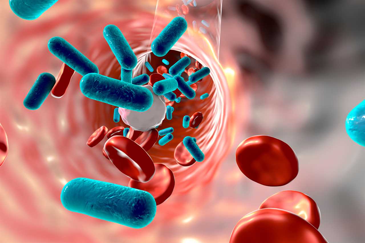 What are the three stages of sepsis and how is it cured?