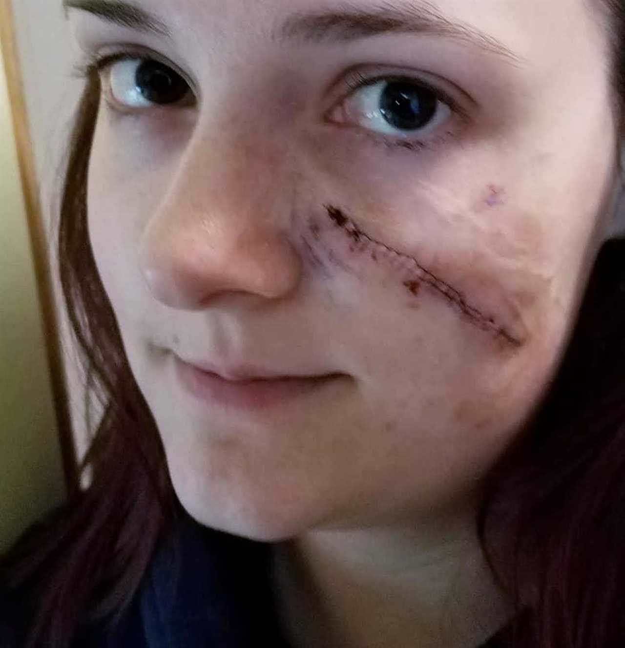 I loved the heart-shaped freckle on my face – until doctors told me it could kill me