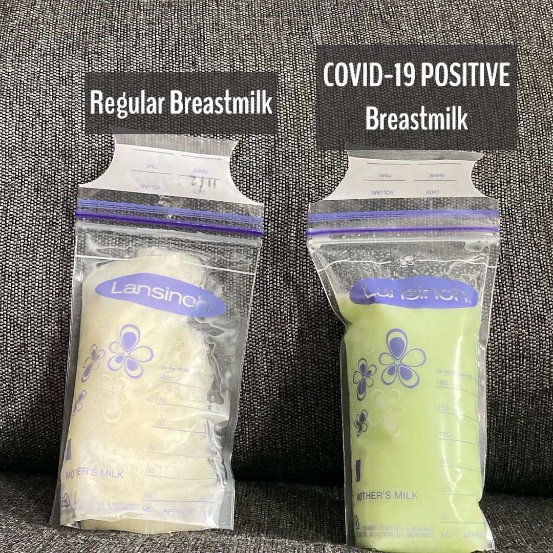 My breast milk went GREEN after I got Covid – so I drank it because I thought it would make me better