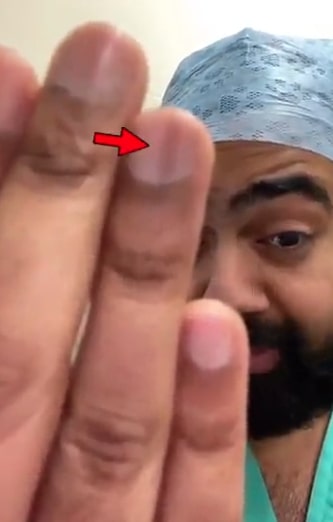 I’m a doctor and here’s the deadly signs on your fingernails you must NEVER ignore