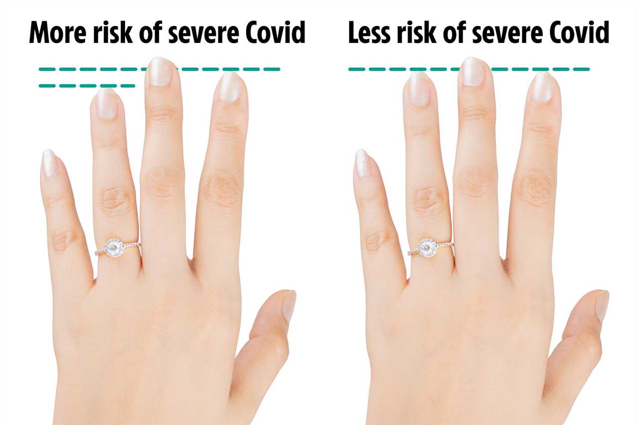 How your finger length can predict how seriously sick you’ll get with Covid