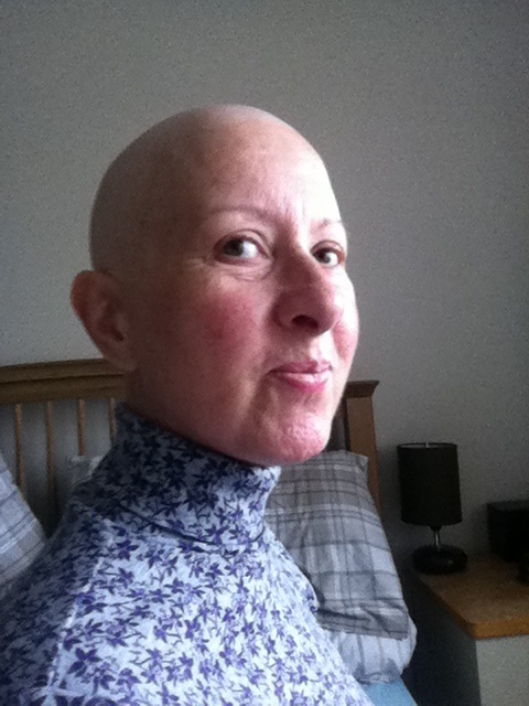 My beautiful wife died of blood cancer after being told nothing was wrong