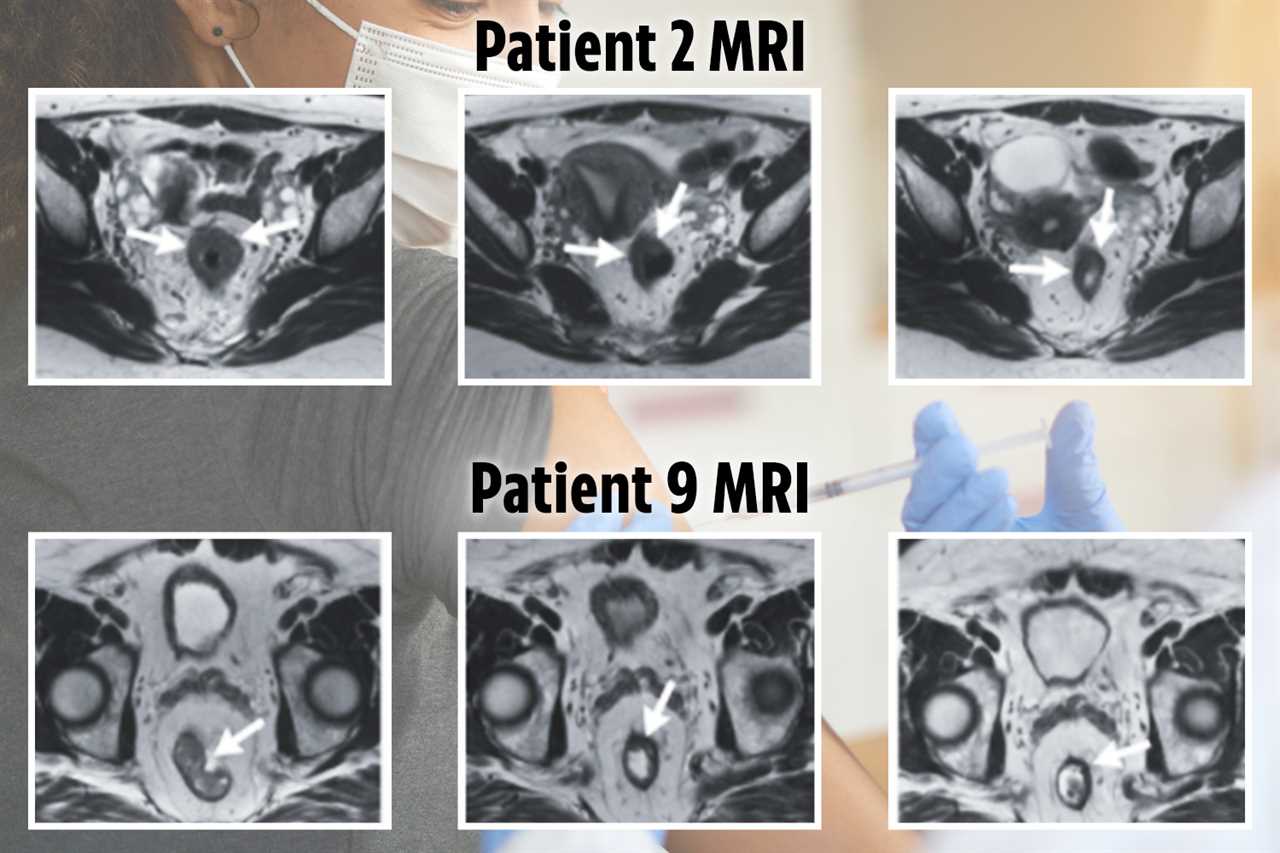 Common 2p-a-day pills could stop cancer turning fatal, experts claim