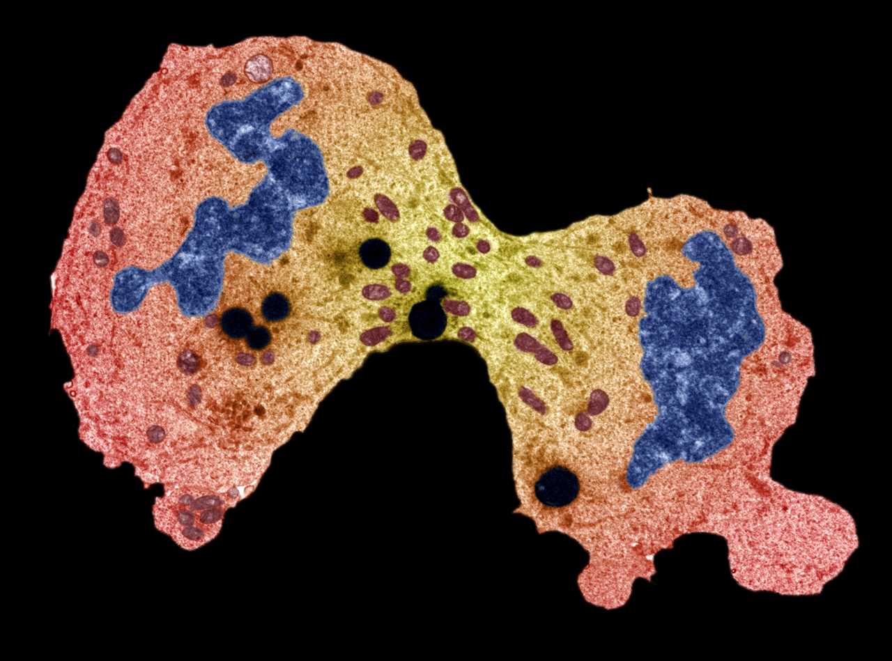 What is sarcoma and what is the survival rate of the cancer?