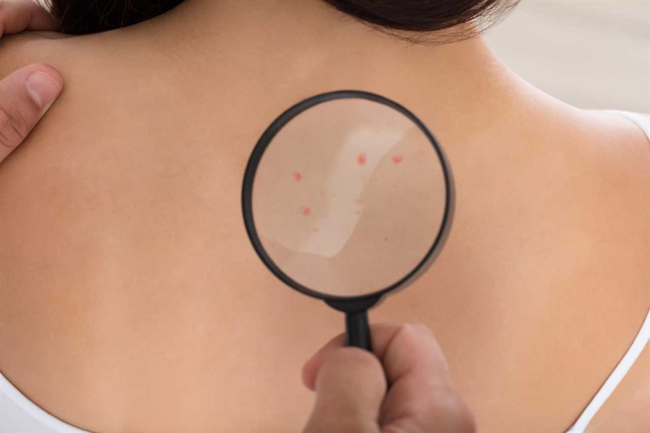 Is skin cancer itchy?