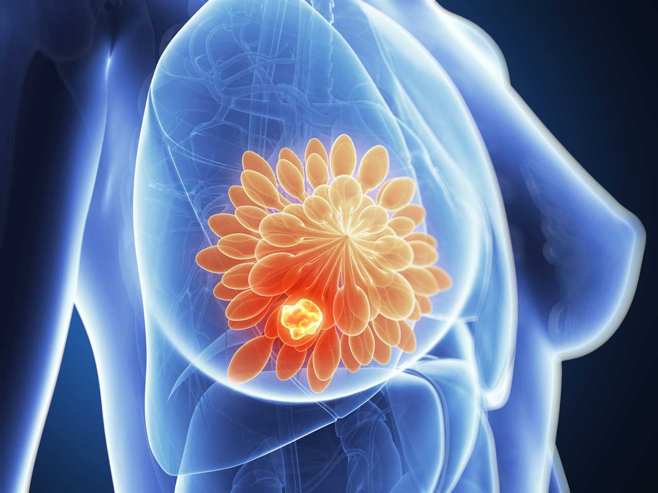 The 8 breast cancer myths you probably think are true