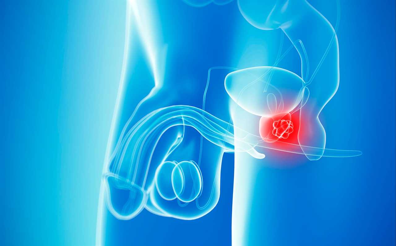 Prostate cancer breakthrough raises hopes of stopping disease in its tracks