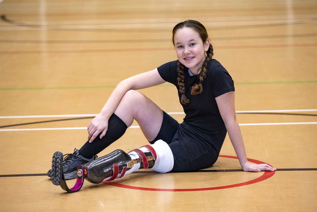 Brave girl, 12, who survived cancer after docs reattached her leg backwards starts running with new prosthetic blade