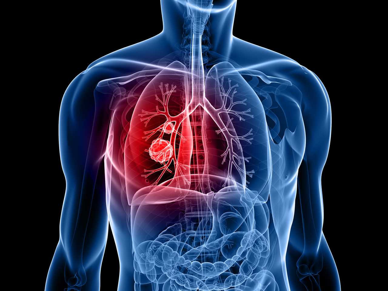 The symptom of deadly lung cancer that strikes as soon as you wake up – and 9 other signs