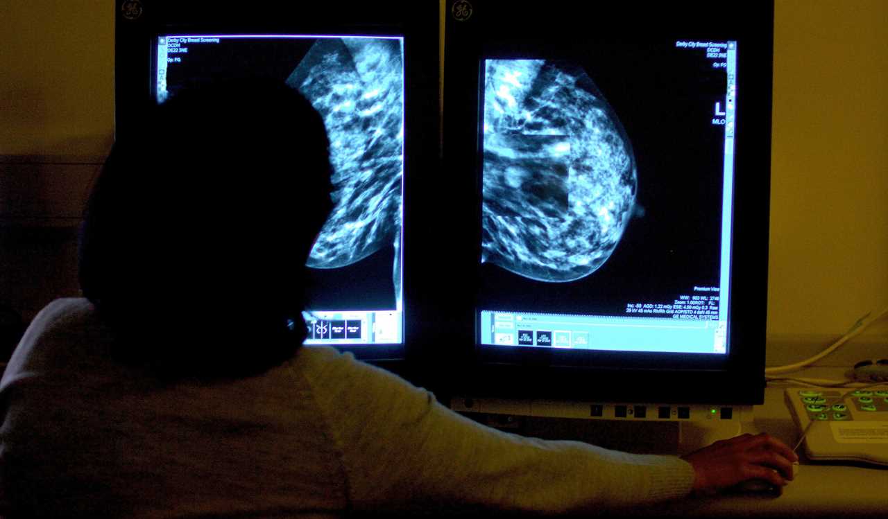 AI is ‘BETTER at spotting killer breast cancer than doctors’, scientists discover