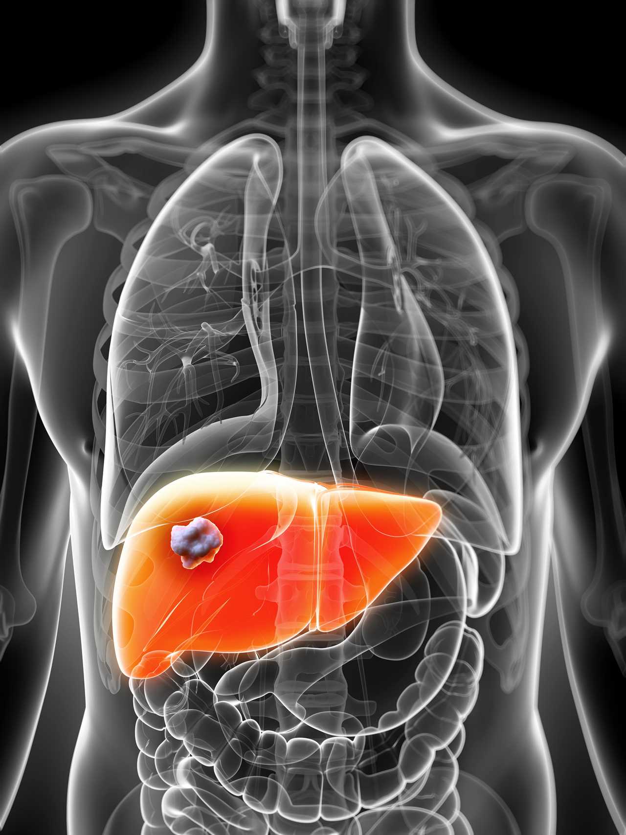 The ‘silent’ symptom of deadly liver cancer you might mistake for indigestion – and 3 other signs you’ve never heard of