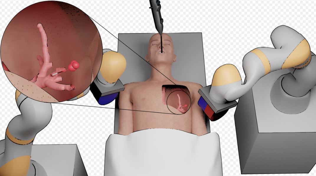 Tiny new robot travels deep into the lungs to ‘detect and treat first signs of cancer’