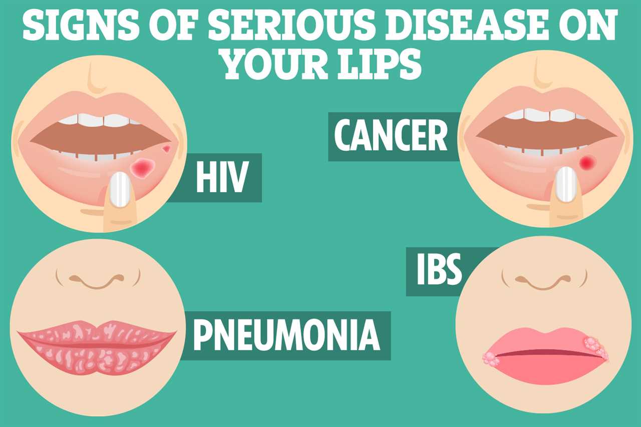 The 4 Serious Diseases You Can Spot on Your Lips - From Cancer to Pneumonia