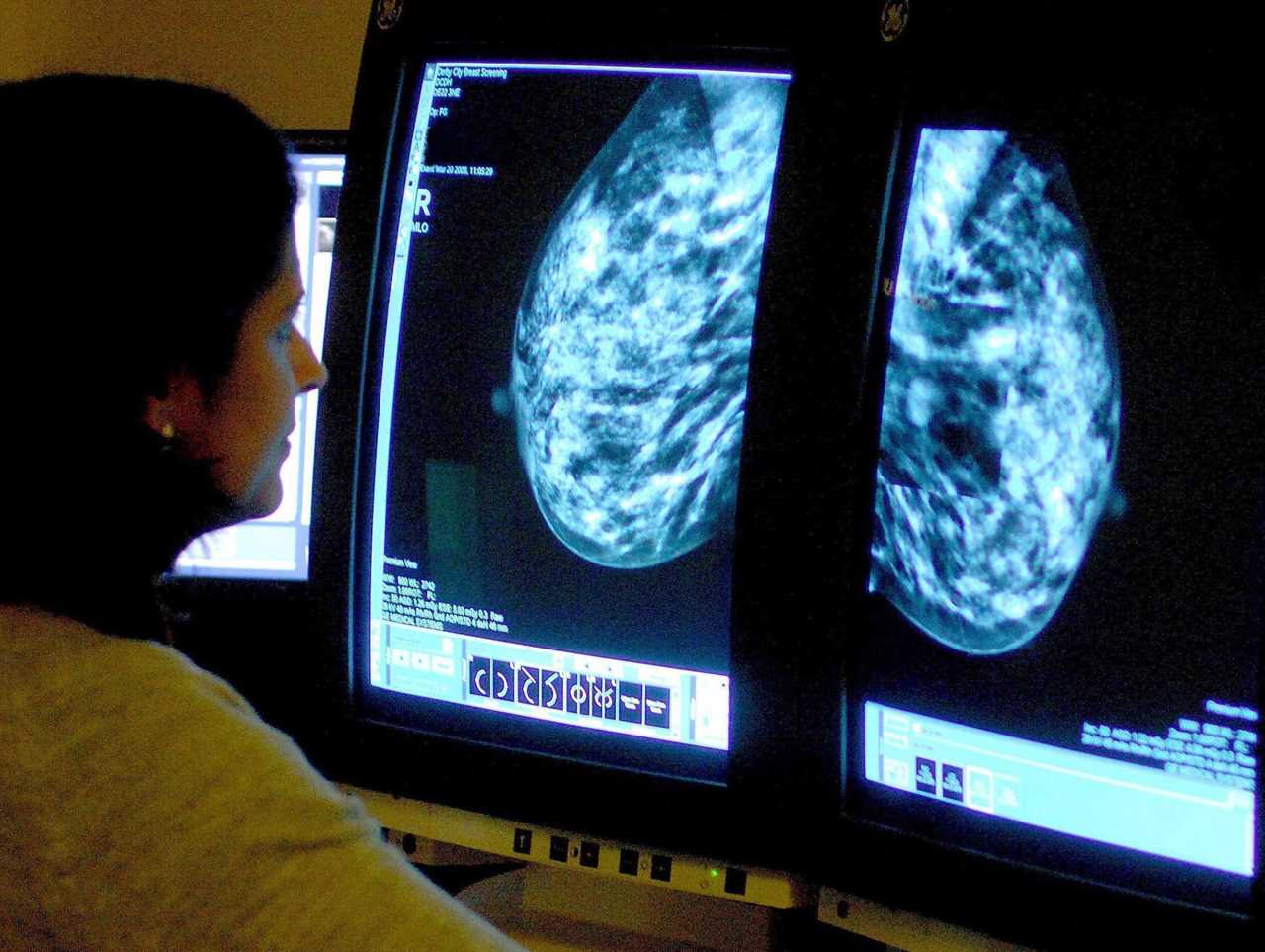 Thousands of Breast Cancer Cases Missed by NHS Screening, Campaigners Warn