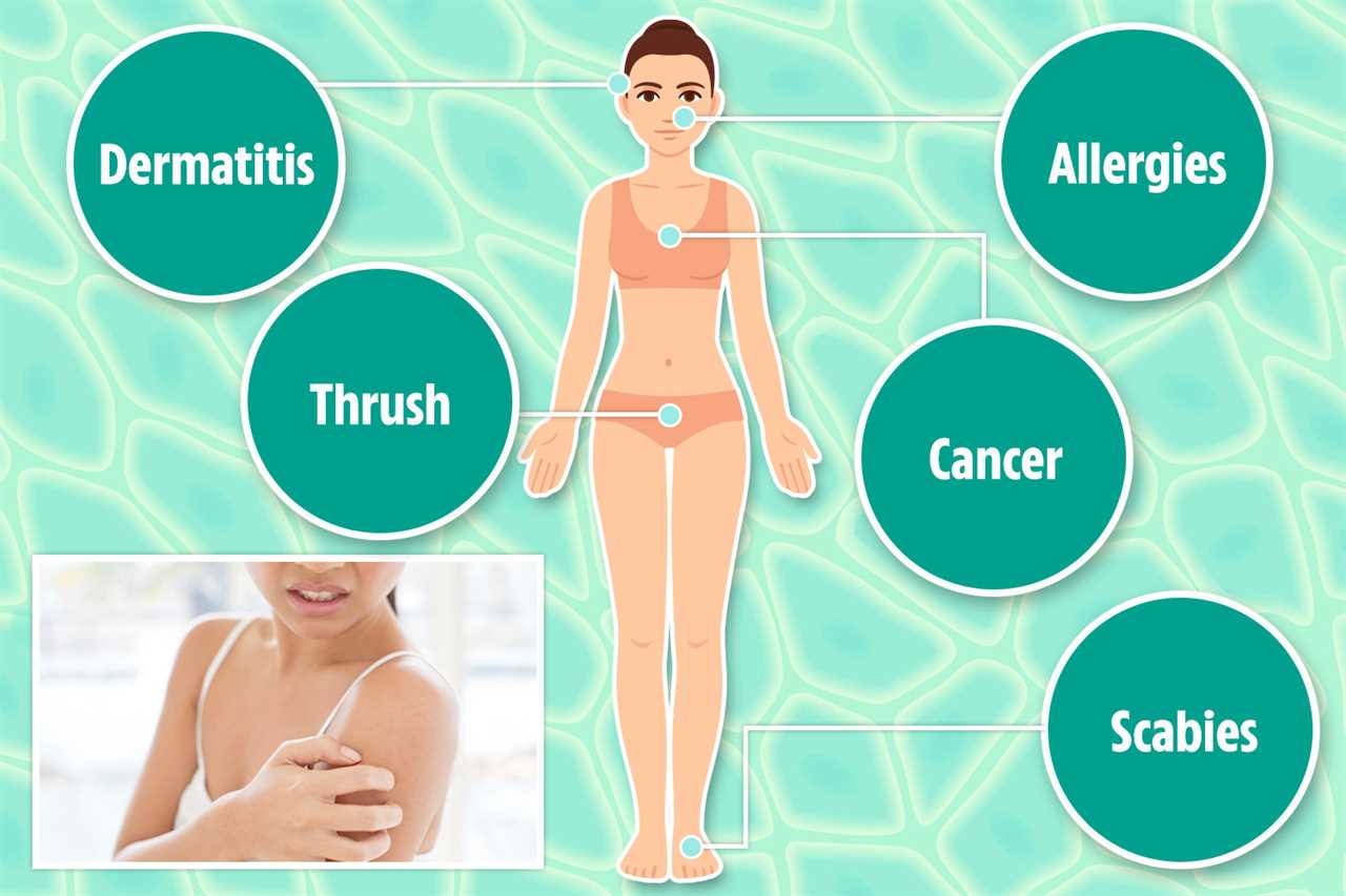 What your itch can reveal about your health – from ancient Egyptian ailment to cancer