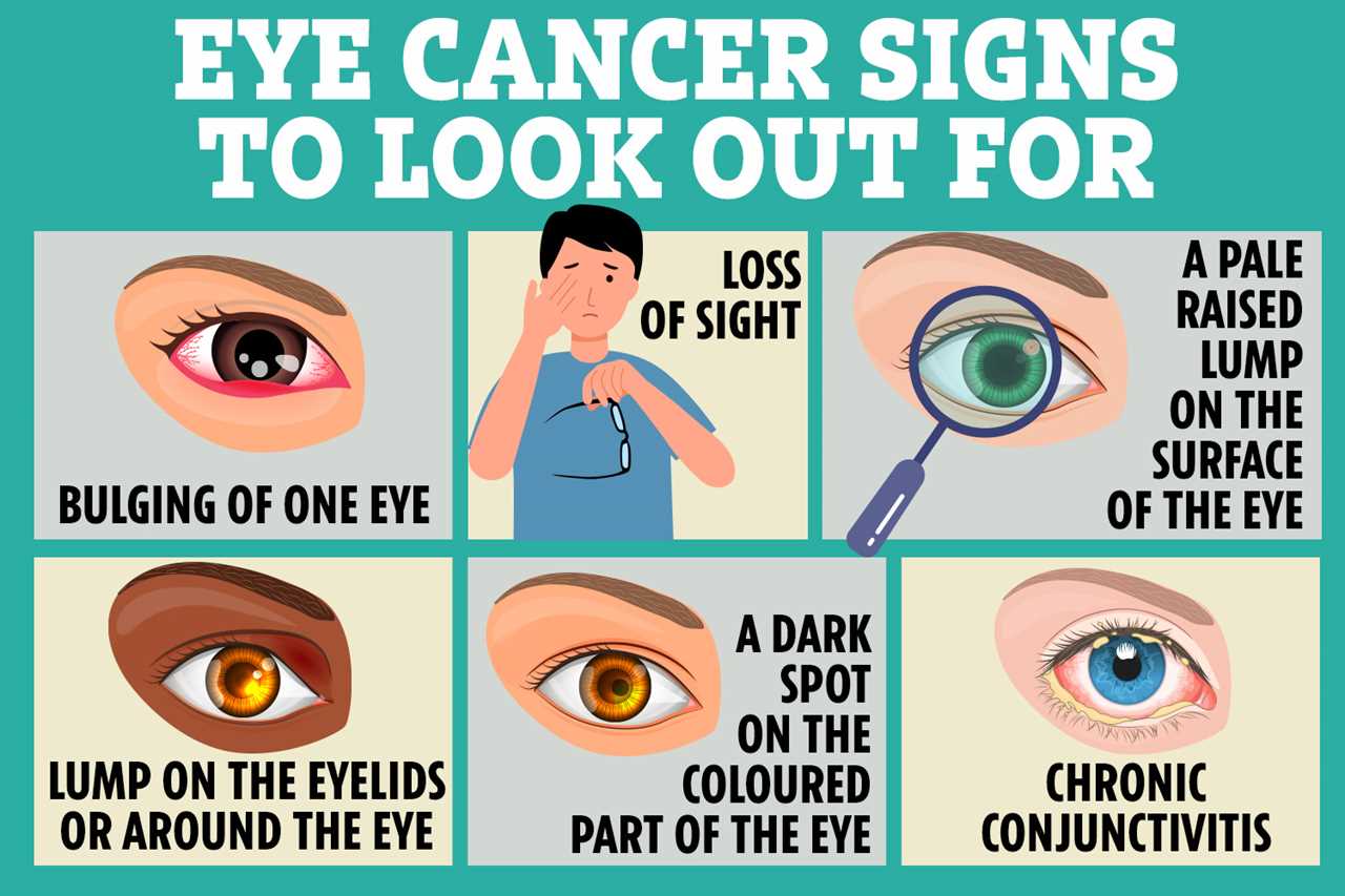 The first signs of cancer you might spot in your eyes – from floaters to blurred vision