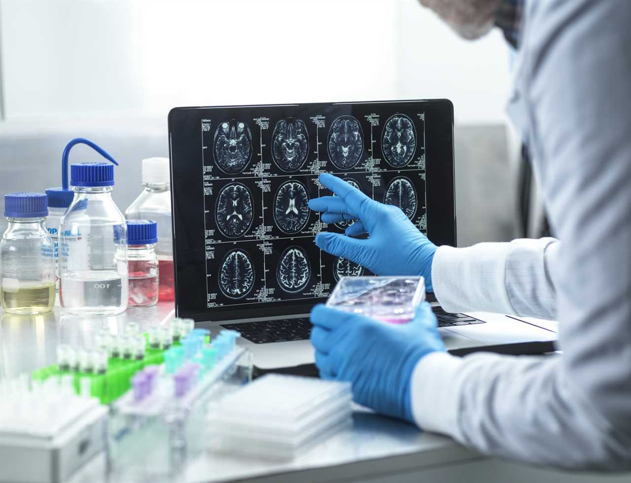 Breakthrough cancer test can spot brain tumours in children in just 10 minutes