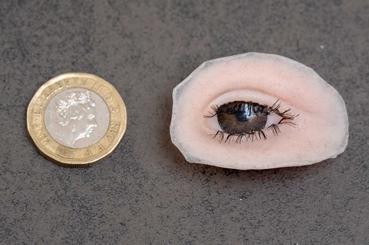 Baby girl with cancer given new prosthetic eye the size of a pound coin