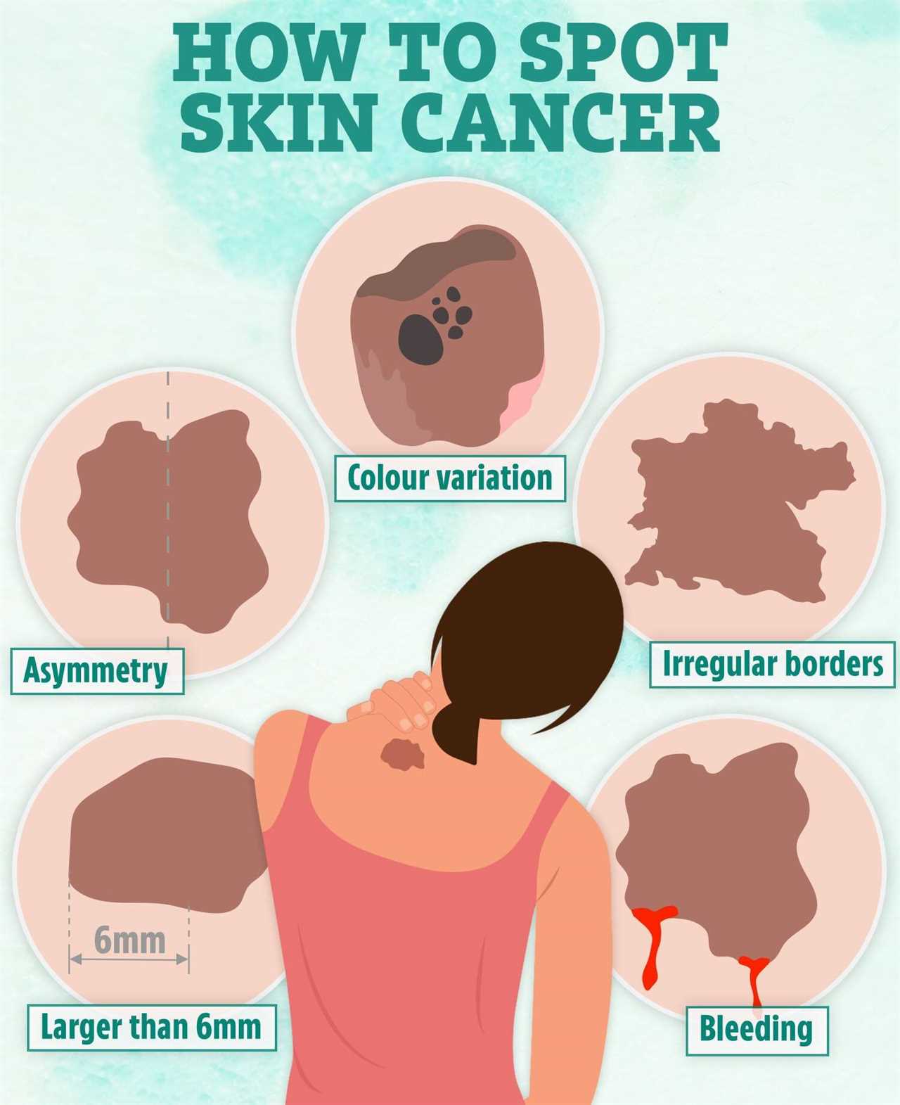 Spot on Your Face: Early Warning Sign of Cancer?