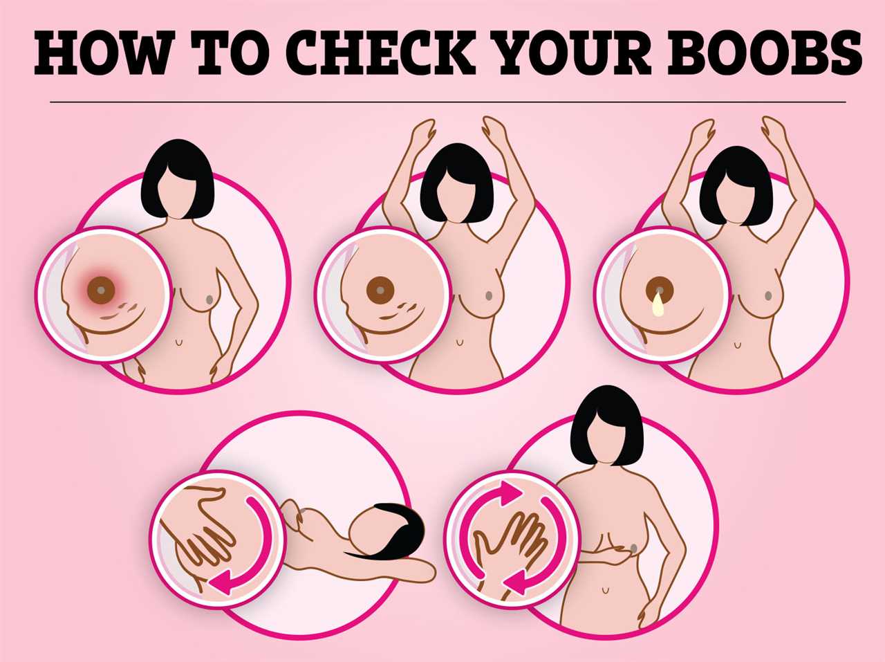 7 Signs of Breast Cancer You Should Know Beyond Lumps