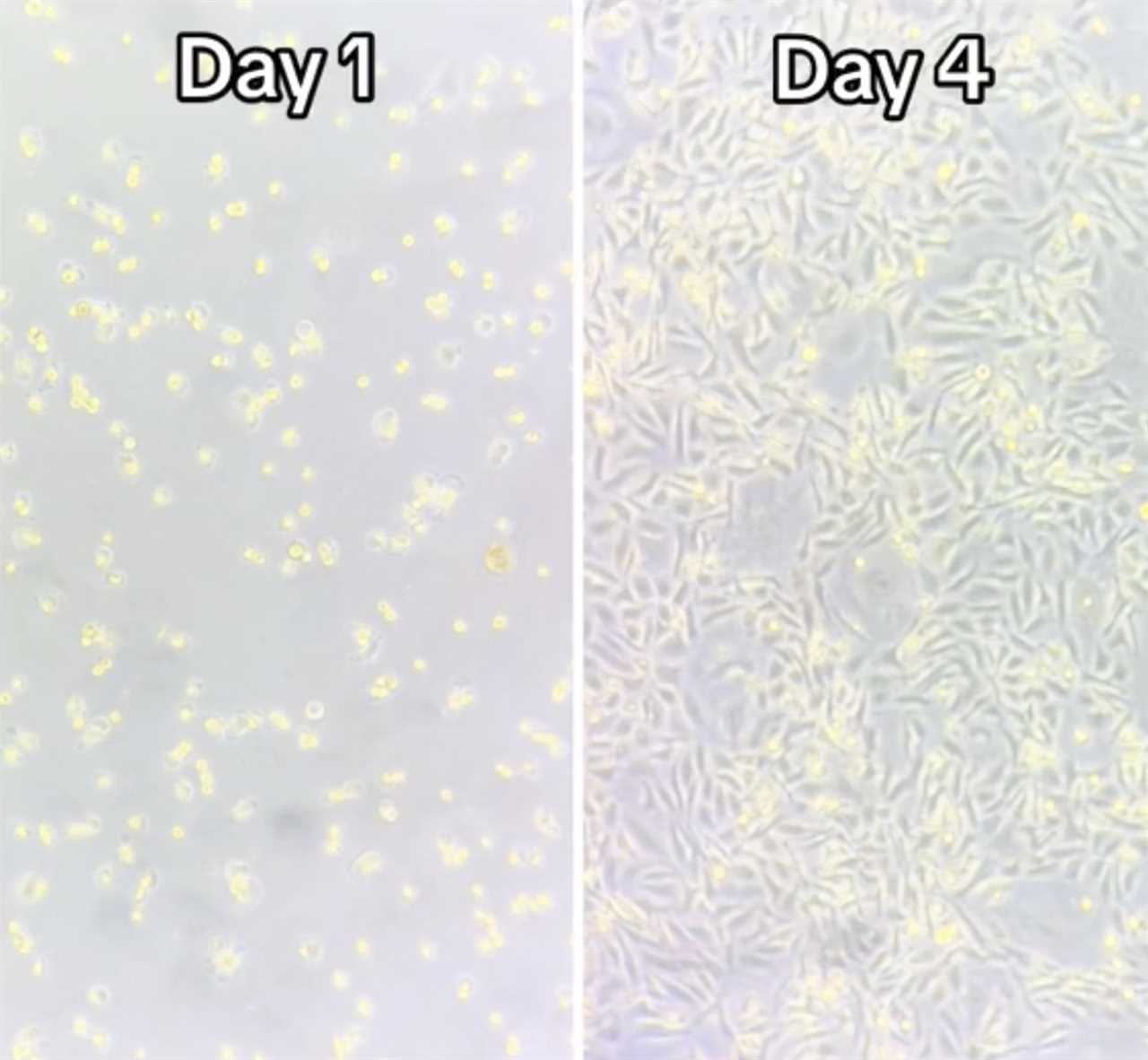 University student reveals shocking speed of cancer cell growth