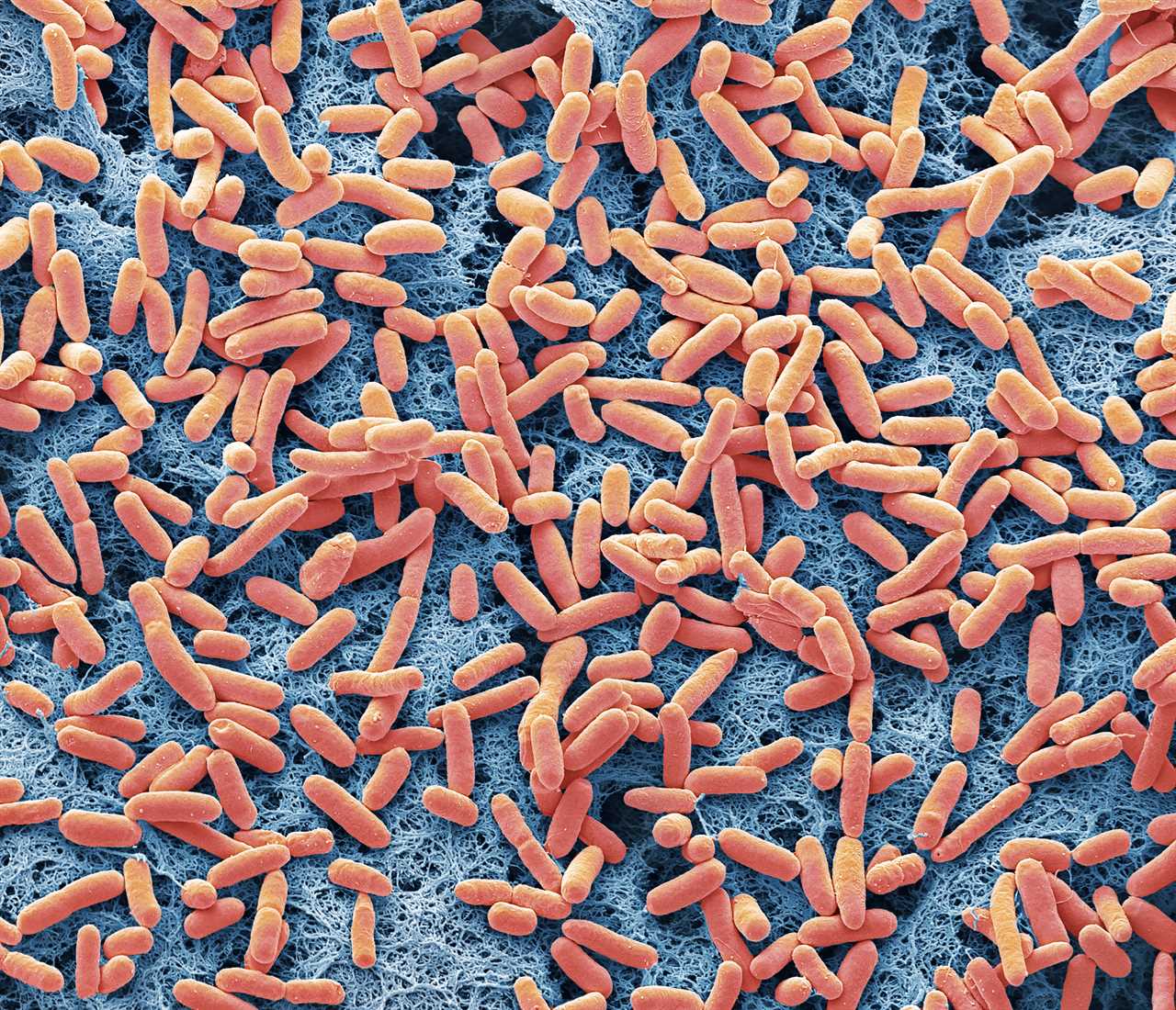 Exploring the Link Between E. coli Toxin and Rising Bowel Cancer Rates in Young People