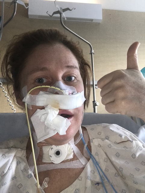 Reconstructive Surgery and Resilience: Overcoming Cancer's Ongoing Challenges