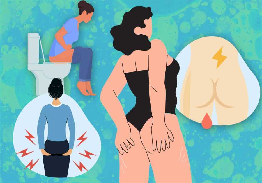 Analysis: Rising Anal Cancer Rates Among Older Women Highlight Urgent Vaccination Needs