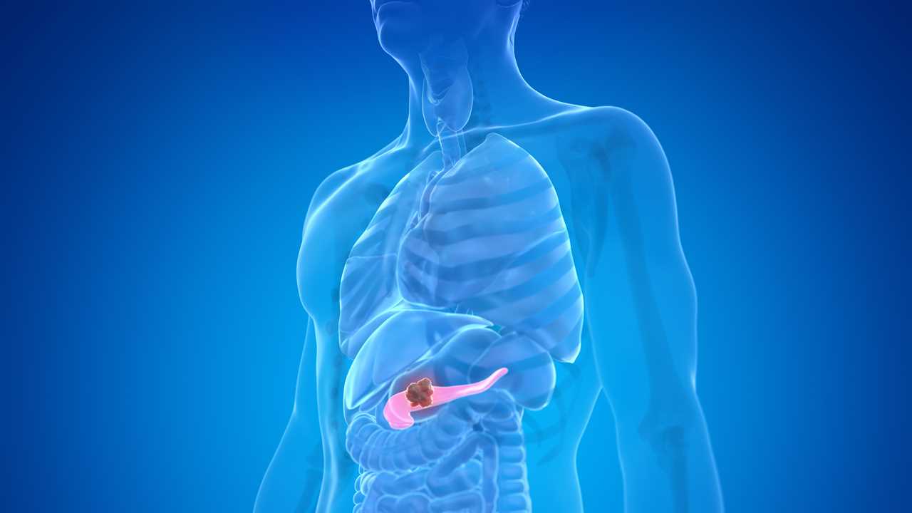 Sugar Substitute in Sweetened Products Offers Potential Against Pancreatic Cancer
