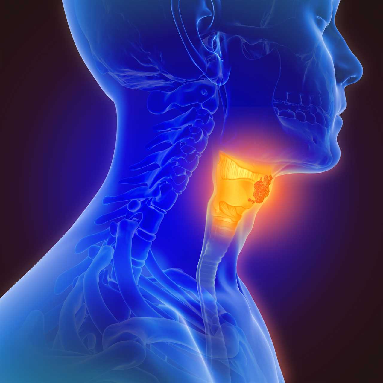 Advancements in Vocal Analysis: Revolutionising Cancer Diagnosis